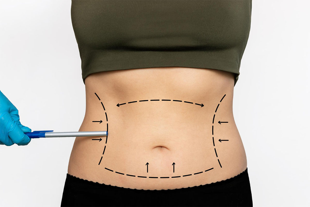 benefits of gastric sleeve surgery