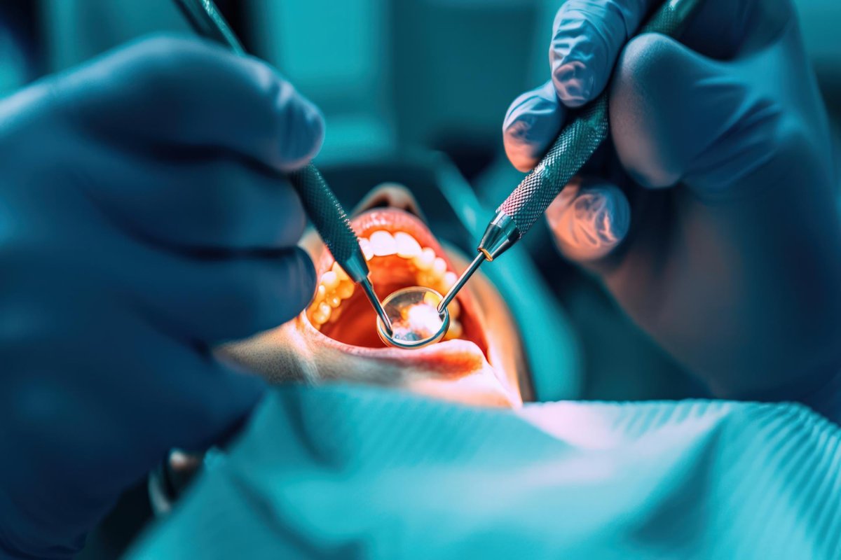 Dental Surgery for Missing Teeth Replacement