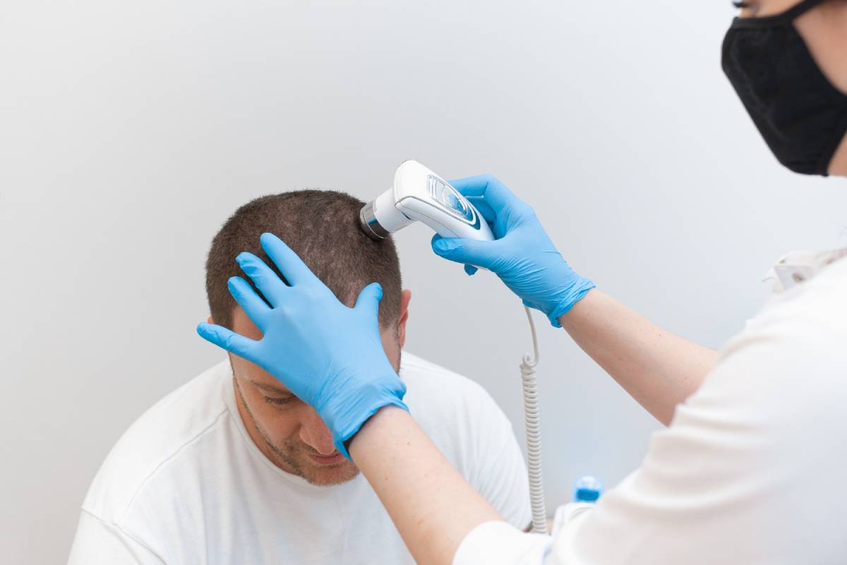 Hair Transplant Recovery: What to Expect Week by Week?